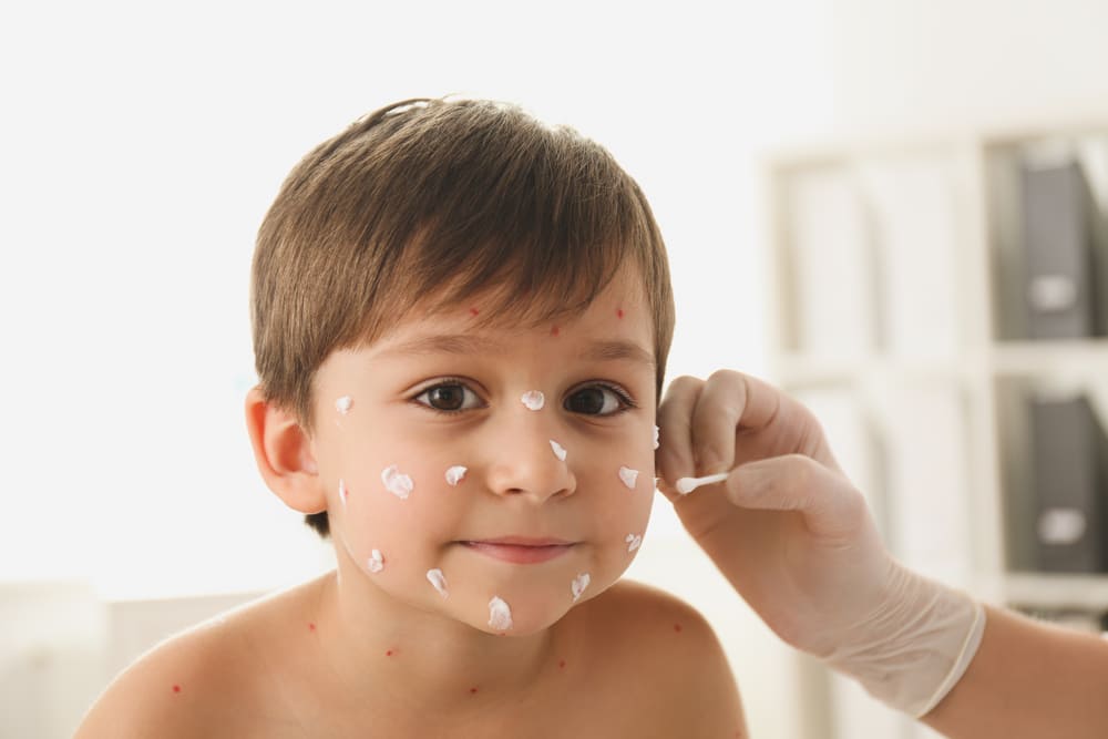 cuidados de la piel de bebés y niños