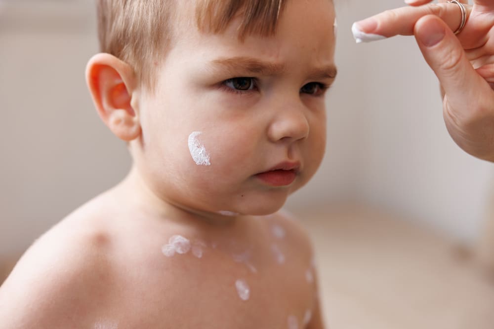 cuidados de la piel de bebés y niños