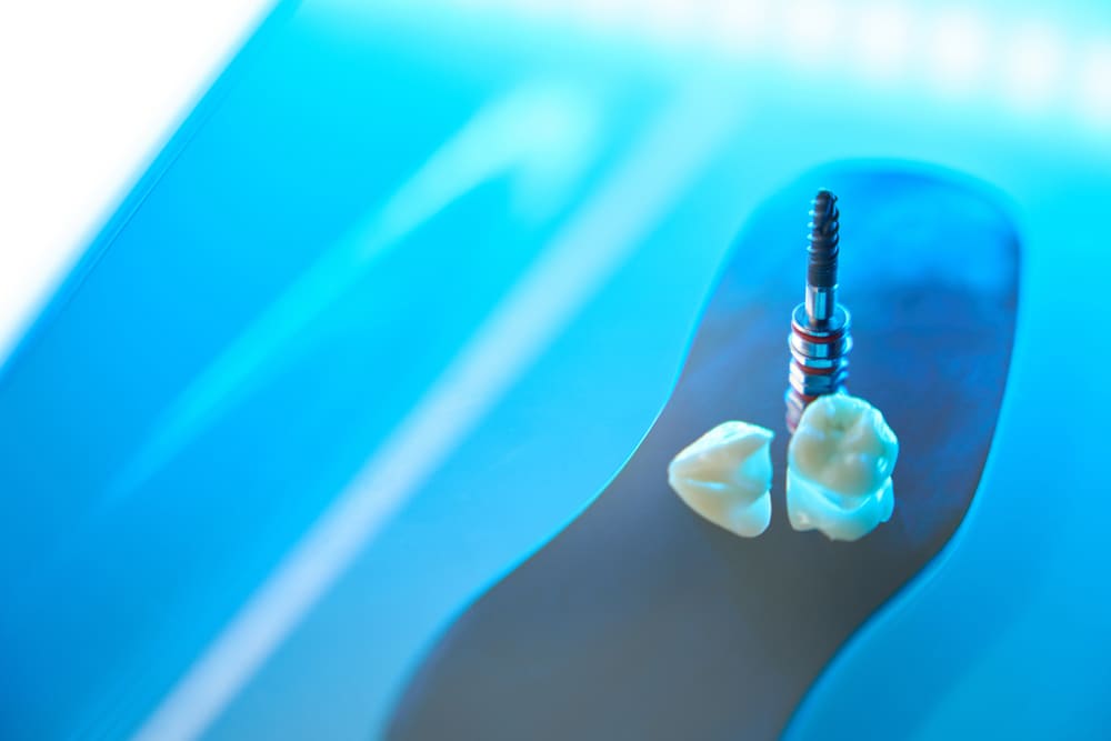 implante dental en Panamá