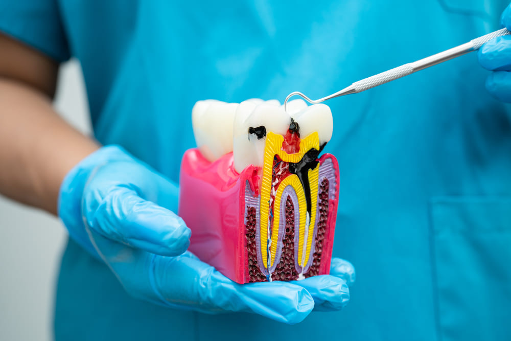 especialistas en endodoncia en Panamá
