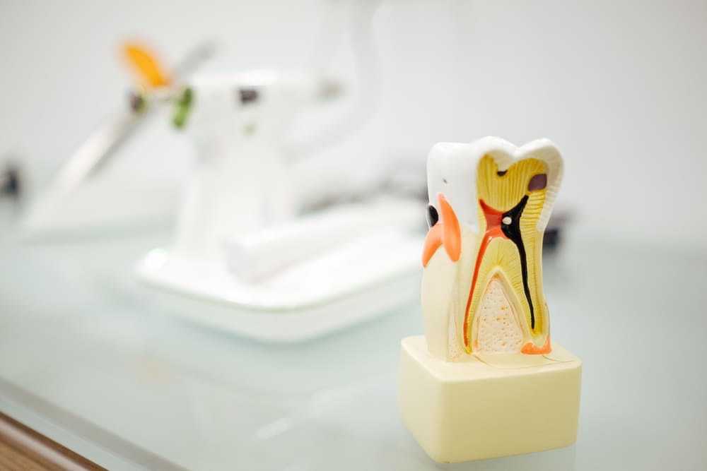 especialistas en endodoncia en Panamá
