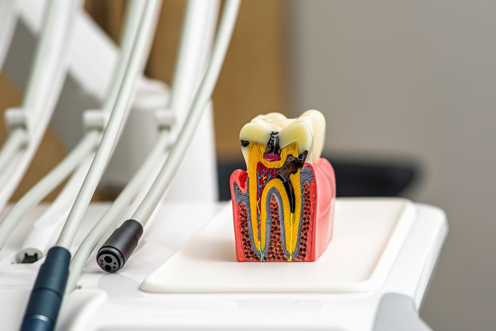 especialistas en endodoncia en Panamá