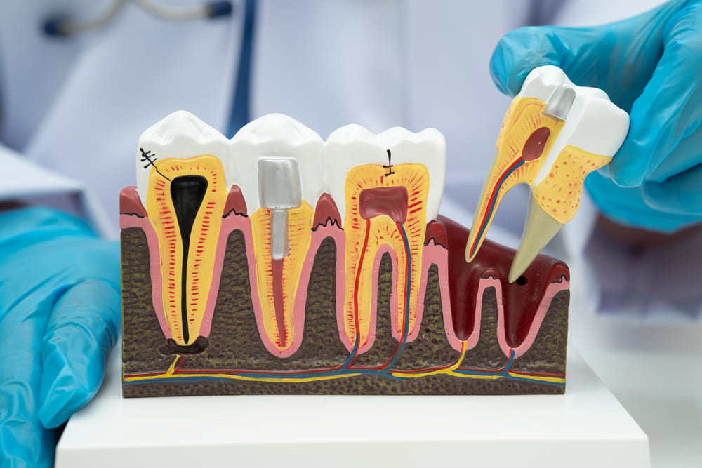 Tratamientos efectivos de periodoncia en Panamá para encías saludables