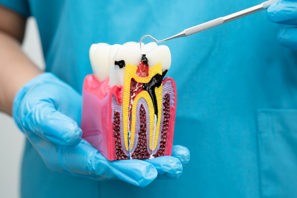 Guía completa sobre periodoncia en Panamá y su impacto en la salud dental general